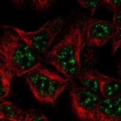 ZNF238 Rabbit anti-Human, Polyclonal, Novus Biologicals 100 &mu;g | Buy Online | Novus Biologicals | Fisher Scientific