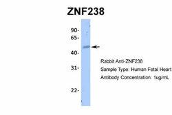 ZNF238 Rabbit anti-Human, Polyclonal, Novus Biologicals 0.1 mL | Buy Online | Novus Biologicals | Fisher Scientific