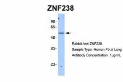 ZNF238 Rabbit anti-Human, Polyclonal, Novus Biologicals 0.1 mL | Buy Online | Novus Biologicals | Fisher Scientific