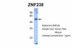 ZNF238 Rabbit anti-Human, Polyclonal, Novus Biologicals 0.1 mL | Buy Online | Novus Biologicals | Fisher Scientific