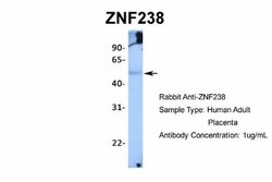 ZNF238 Rabbit anti-Human, Polyclonal, Novus Biologicals 0.1 mL | Buy Online | Novus Biologicals | Fisher Scientific
