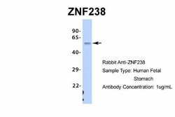 ZNF238 Rabbit anti-Human, Polyclonal, Novus Biologicals 0.1 mL | Buy Online | Novus Biologicals | Fisher Scientific
