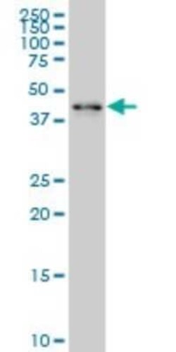 ZNF24 Antibody (4C2), Novus Biologicals 0.1 mg | Buy Online | Novus Biologicals | Fisher Scientific