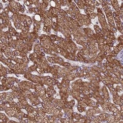 ZNF248 Antibody, Novus Biologicals 25 &mu;L, Unconjugated:Antibodies, Polyclonal