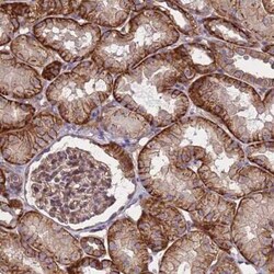 ZNF248 Antibody, Novus Biologicals:Antibodies:Primary Antibodies