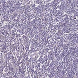ZNF248 Antibody, Novus Biologicals 25 &mu;L, Unconjugated:Antibodies, Polyclonal