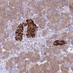 ZNF248 Antibody, Novus Biologicals 25 &mu;L, Unconjugated:Antibodies, Polyclonal