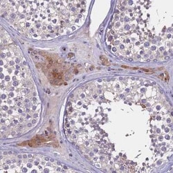 ZNF248 Antibody, Novus Biologicals 25 &mu;L, Unconjugated:Antibodies, Polyclonal