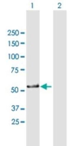 ZNF259 Antibody, Novus Biologicals 0.05 mg | Buy Online | Novus Biologicals | Fisher Scientific