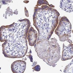 ZNF26 Antibody, Novus Biologicals:Antibodies:Primary Antibodies