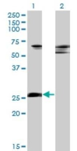 ZNF266 Antibody (4G5), Novus Biologicals 0.1 mg | Buy Online | Novus Biologicals | Fisher Scientific