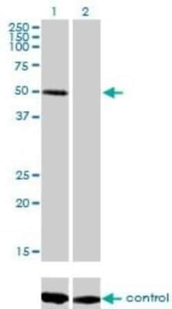 ZNF277 Antibody (1B2), Novus Biologicals 0.1 mg | Buy Online | Novus Biologicals | Fisher Scientific