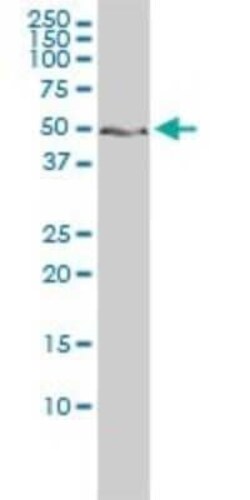 ZNF277 Antibody (1B2), Novus Biologicals 0.1 mg | Buy Online | Novus Biologicals | Fisher Scientific