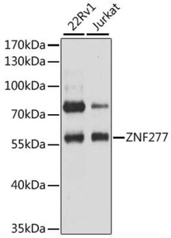 ZNF277 Antibody - Azide and BSA Free, Novus Biologicals 0.02 mL, Unconjugated:Antibodies,