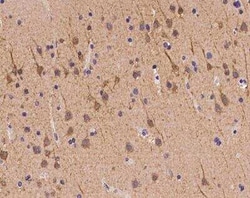 ZNF292 Antibody, Novus Biologicals 100 &mu;g; Unconjugated:Antibodies,