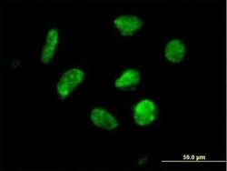 ZNF302 Antibody, Novus Biologicals 0.05 mg | Buy Online | Novus Biologicals | Fisher Scientific