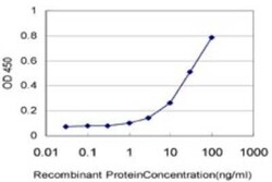 ZNF31 Antibody (2C7), Novus Biologicals 0.1 mg, Unconjugated:Antibodies,