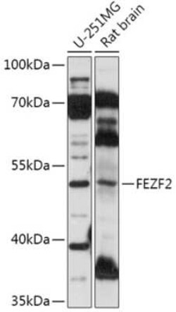 ZNF312 Antibody - Azide and BSA Free, Novus Biologicals 0.02 mL; Unconjugated:Antibodies,