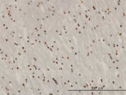 ZNF313 Antibody (4G3-1A10), Novus Biologicals 0.1 mg | Buy Online | Novus Biologicals | Fisher Scientific