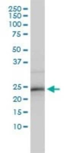 ZNF313 Antibody (4G3-1A10), Novus Biologicals 0.1 mg | Buy Online | Novus Biologicals | Fisher Scientific