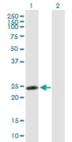 ZNF313 Antibody, Novus Biologicals 50 &mu;g | Buy Online | Novus Biologicals | Fisher Scientific