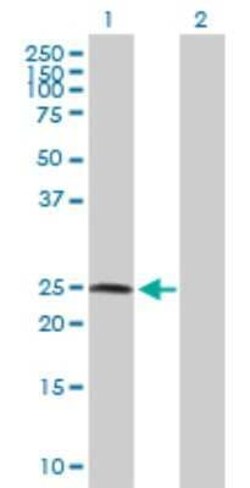 ZNF313 Antibody, Novus Biologicals 0.1 mg | Buy Online | Novus Biologicals | Fisher Scientific