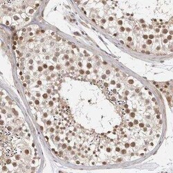 ZNF318 Antibody, Novus Biologicals:Antibodies:Primary Antibodies