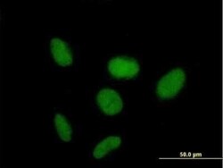 ZNF319 Antibody, Novus Biologicals 0.05 mg | Buy Online | Novus Biologicals | Fisher Scientific