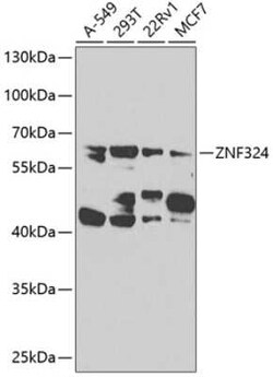 ZNF324 Antibody - BSA Free, Novus Biologicals 0.02 mL | Buy Online | Novus Biologicals | Fisher Scientific