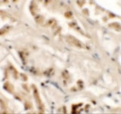 ZNF336 Antibody - BSA Free, Novus Biologicals 0.1 mg; Unconjugated:Antibodies,