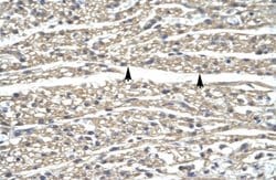 ZNF336 Rabbit anti-Human, Polyclonal, Novus Biologicals 0.1ml; Unconjugated:Antibodies,