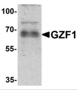 ZNF336 Antibody - BSA Free, Novus Biologicals 0.1 mg; Unconjugated:Antibodies,