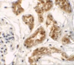ZNF346 Antibody - BSA Free, Novus Biologicals:Antibodies:Primary Antibodies