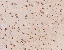 ZNF346 Antibody, Novus Biologicals 100 &mu;g; Unconjugated:Antibodies,