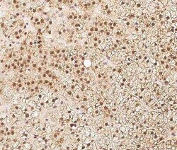 ZNF346 Antibody, Novus Biologicals 100 &mu;g; Unconjugated:Antibodies,