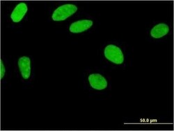 ZNF35 Antibody (2B4), Novus Biologicals 0.1 mg | Buy Online | Novus Biologicals | Fisher Scientific