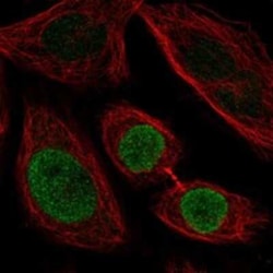 ZNF354C Rabbit anti-Human, Polyclonal, Novus Biologicals 100 &mu;g | Buy Online | Bio-Techne | Fisher Scientific