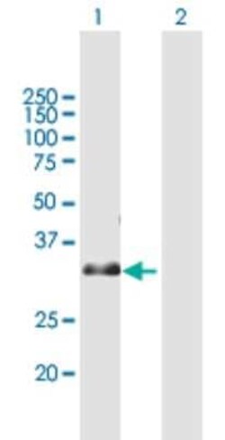 Novus Biologicals ZNF364 Antibody, Novus Biologicals 0.05 mg | Buy Online | Novus Biologicals&trade; | Fisher Scientific