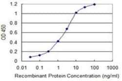 ZNF365 Antibody (2E3), Novus Biologicals 0.1 mg | Buy Online | Novus Biologicals | Fisher Scientific