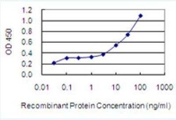 Novus Biologicals ZNF37A Antibody (4H9), Novus Biologicals 100 &mu;g | Buy Online | Novus Biologicals&trade; | Fisher Scientific