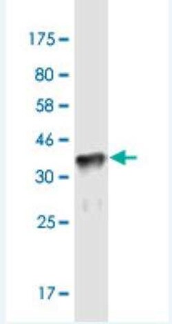 Novus Biologicals ZNF37A Antibody (4H9), Novus Biologicals 100 &mu;g | Buy Online | Novus Biologicals&trade; | Fisher Scientific