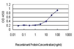 ZNF37A Antibody (5F9), Novus Biologicals 0.1 mg | Buy Online | Novus Biologicals | Fisher Scientific