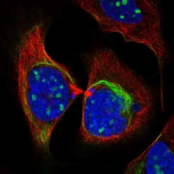 ZNF404 Antibody, Novus Biologicals 25ul; Unconjugated:Antibodies, Polyclonal