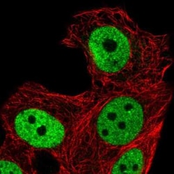 ZNF41 Antibody, Novus Biologicals:Antibodies:Primary Antibodies