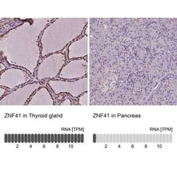 ZNF41 Antibody, Novus Biologicals:Antibodies:Primary Antibodies