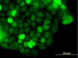 ZNF415 Antibody, Novus Biologicals 0.05 mg | Buy Online | Novus Biologicals | Fisher Scientific