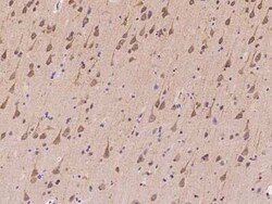 ZNF415 Antibody, Novus Biologicals 100 &mu;g | Buy Online | Novus Biologicals | Fisher Scientific