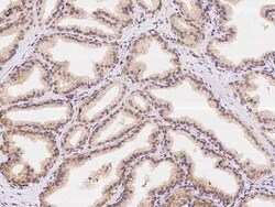 ZNF415 Antibody, Novus Biologicals 100 &mu;g | Buy Online | Novus Biologicals | Fisher Scientific