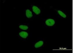 ZNF43 Antibody, Novus Biologicals 0.05 mg | Buy Online | Novus Biologicals | Fisher Scientific