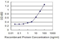 ZNF44 Antibody (4E2), Novus Biologicals 0.1 mg | Buy Online | Novus Biologicals | Fisher Scientific